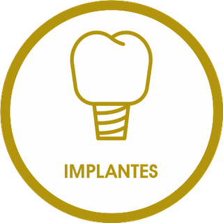 Implantes & Protocolo